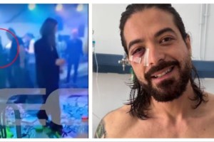 Θεσσαλονίκη: Πληροφορίες για σοβαρό ατύχημα από βεγγαλικό πριν το ΠΑΟΚ-Μπιλμπάο