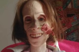 Αννα Κόκορη: Συγκλονίζει η νεαρή δημοσιογράφος για τη μάχη με τη νευρική ανορεξία - "Ζύγιζα 30 κιλά, αργοπέθαινα"