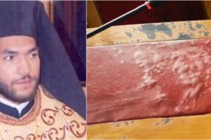 Σοκ στο Αγρίνιο: Γυναίκα έριξε χλωρίνη στον σύζυγό της μετά από καβγά