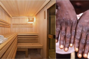 Μαγιορκίνης: Η ευλογιά των πιθήκων δεν θα έχει τη δυναμική του κορονοϊού - εικόνα 2