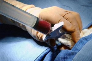 Παγκόσμιο "μυστήριο" η μείωση εμφραγμάτων εν μέσω της πανδημίας κορονοϊού [Βίντεο]