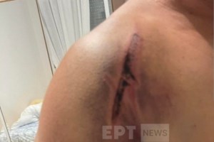 Θεσσαλονίκη: Νέα επίθεση σε οδηγό του ΟΑΣΘ - Τους ζήτησε να σβήσουν το τσιγάρο και του επιτέθηκαν