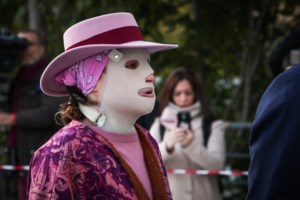 Επίθεση με βιτριόλι: Έχει μπροστά της 10 επικίνδυνα χειρουργεία λέει η γιατρός της Ιωάννας Παλιοσπύρου