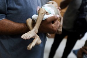"Γέφυρα" σωτηρίας για εκατοντάδες παιδιά από τη Γάζα: Θα μεταφερθούν στη Βρετανία για ιατρική φροντίδα