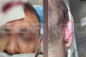 Aτύχημα στο Allou Fun Park: Σήμερα η αυτοψία του πραγματογνώμονα στο παιχνίδι