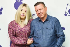 Το δέκατο χειρουργείο για την Ιωάννα Παλιοσπύρου: Η φωτογραφία χωρίς μάσκα με τις γάζες στο κρεβάτι - εικόνα 3