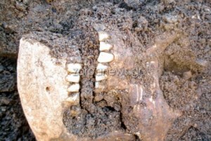 Μακάβριο εύρημα στη Μυτιλήνη: Σάκοι με ανθρώπινα οστά στον Σταθμό Μεταφόρτωσης Απορριμμάτων