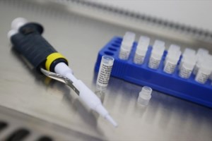 Κορονοϊός - Τζορτζ Γιανκόπουλος: Ποιος είναι ο Ελληνοαμερικανός επιστήμονας πίσω από το φάρμακο αντισωμάτων - εικόνα 3