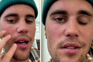 Ramsay Hunt: Πώς είναι να ζεις με το σύνδρομο που πάσχει ο Τζάστιν Μπίμπερ