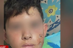 Λαγονήσι: Ανιψιός της Μαρίας Καλάβρια ο 13χρονος που δέχθηκε επίθεση από σκύλο - "Απαράδεκτο" [Βίντεο]