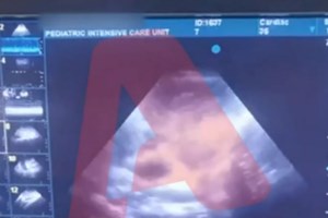 Δίκη Πισπιρίγκου: Ερχόταν ήρεμα και μας έλεγε "ελάτε, κάνει επεισόδιο η Τζωρτζίνα", κατέθεσε παιδίατρος