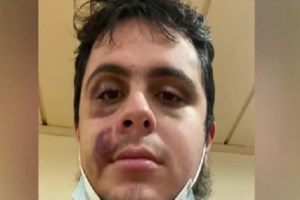 Χαλκιδική: Άγριο ξύλο με τραυματίες σε ποδοσφαιρικό αγώνα - Χτύπησαν και τον προπονητή - εικόνα 2