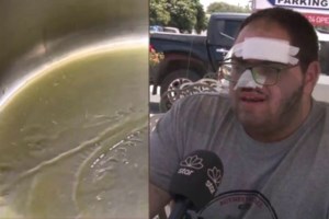 Βόλος: "Επέζησα γιατί η φωτιά μέσα μου έκαιγε πιο φωτεινή" - Συγκλονίζει η 22χρονη που υπέστη σοβαρά εγκαύματα ανάβοντας σόμπα - εικόνα 2