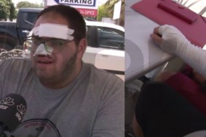 Κρήτη: "Τελείωνε, βιαζόμαστε"- Η "έκρηξη" στο λάδι που προκάλεσε τα εγκαύματα στον 22χρονο μάγειρα - εικόνα 4