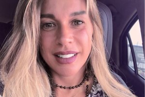 Η Έρρικα Πρεζεράκου δείχνει για πρώτη φορά το χέρι της μετά το σοβαρό ατύχημα