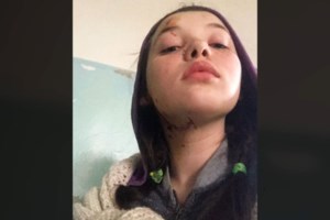 Στιγμές πανικού στο αεροδρόμιο του Τελ Αβίβ - Οβίδα βρέθηκε σε αποσκευές τουριστών [Βίντεο]