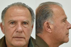 Αθηναΐς Νέγκα: Η σεξουαλική παρενόχληση στη δημοσιογραφία δε θα αποκαλυφθεί ποτέ [βίντεο] - εικόνα 2