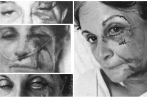 Αίγινα: Αυτοί είναι οι κατηγορούμενοι για τον άγριο ξυλοδαρμό της γνωστής ξενοδόχου και του γιου της - εικόνα 6