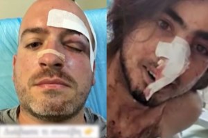 Πάρνηθα: Στα ίχνη των 7 που μαχαίρωσαν και ξυλοκόπησαν τους εθελοντές η ΕΛΑΣ - Πού κατέφυγαν μετά την επίθεση