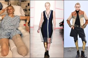 Μ.Βρετανία: Συγκίνηση για τον Βουλευτή που του έκοψαν τα άνω και κάτω άκρα λόγω σηψαιμίας- Τον έσωσε η γυναίκα του που είδε τη μόλυνση - εικόνα 6