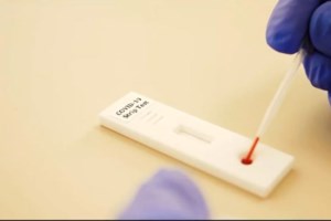 "Αντάρτικο" και από τον Πρόεδρο του Πανελλήνιου Φαρμακευτικού Συλλόγου: Αδύνατον να κάνουμε τα test στο φαρμακείο