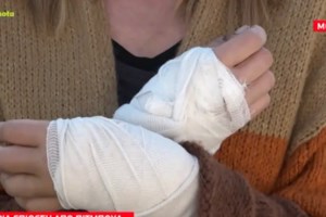 Επίθεση στη Θεσσαλονίκη: Τον λήστεψαν και τον τραυμάτισαν ενώ έβγαινε από αστικό λεωφορείο