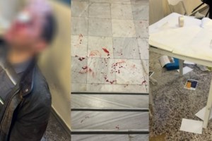 Τρόμος στον Βόλο: Άγνωστοι επιτέθηκαν με μαχαίρι σε θαμώνες καταστήματος