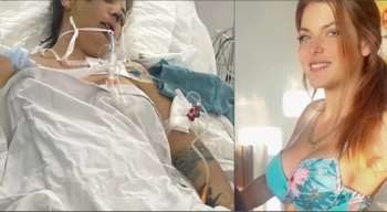 Χαροπαλεύει 31χρονη από την Αυστραλία: Πήγε στο Βιετνάμ για επέμβαση αισθητικής και βρέθηκε στην εντατική