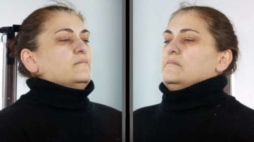 Αττική: Δημοσιοποιήθηκαν τα στοιχεία της 45χρονης που παρίστανε την οικιακή βοηθό και έκλεβε ΑμεΑ