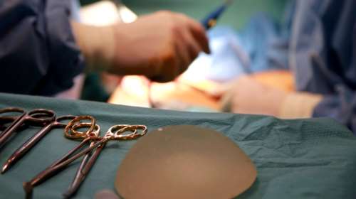 Ξανά στο προσκήνιο το &quot;θρίλερ&quot; των πλαστικών στήθους με ελαττωματικά εμφυτεύματα