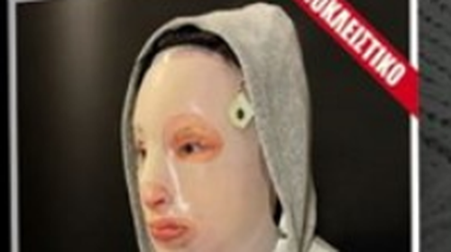 Επίθεση με βιτριόλι: Η πρώτη φωτό της 34χρονης Ιωάννας Παλιοσπύρου, 10 μήνες μετά την επίθεση με βιτριόλι