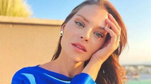 10 χρόνια νεότερη: Η θεραπεία με εξωσώματα που έκανε η Υβόννη Μπόσνιακ