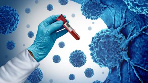 Γιατί προκλήθηκε ανησυχία με τα self tests για τον καρκίνο του παχέος εντέρου