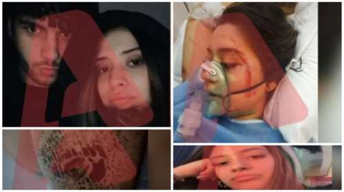 Τέμπη: "Ο κόσμος καιγόταν, έπεφτε από τα βαγόνια" - Η ανατριχιαστική περιγραφή της 19χρονης Βασιλικής που σώθηκε