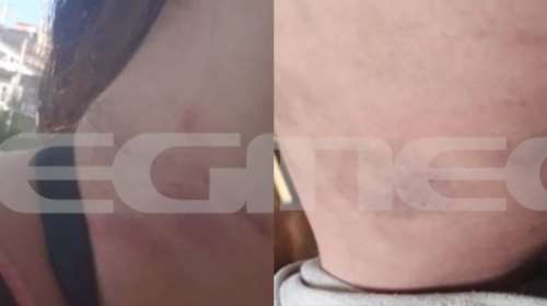 &quot;Θα κάνεις μήνυση; - Όχι- Κάτσε να τις φας&quot;: Εξοργιστική καταγγελία για γυναίκα αστυνομικό- Την άφησαν στη μέση του δρόμου