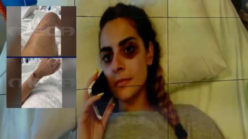 Allou Fan Park: Βγήκε από την εντατική η Αγγελική - Χτύπησε σε θώρακα και πνεύμονες, 4 σπασμένα πλευρά