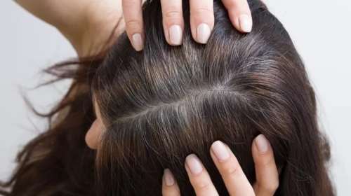 Επιστήμονες ανακαλύπτουν φυσική θεραπεία για τα γκρίζα μαλλιά – Το συστατικό που αποτρέπει το γκριζάρισμα + σε ποιες τροφές θα το βρεις!