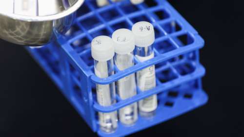 Ολα όσα ξέρουμε (μέχρι στιγμής) για τη μετάλλαξη Ομικρον - Γιατί δεν ξέρουμε πόσο προστατεύουν τα εμβόλια