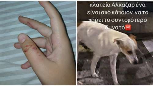 Λάρισα: Αδέσποτο σκυλί δάγκωσε 12χρονο κορίτσι και το έστειλε στο νοσοκομείο