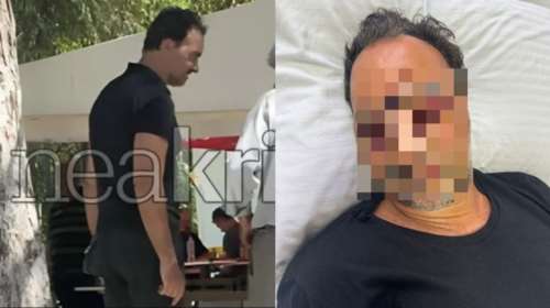 Κρήτη: Εξιτήριο για τον Ελληνοκαναδό που ξυλοκοπήθηκε άγρια- Έχει προβλήματα όρασης, ασύλληπτοι οι δράστες