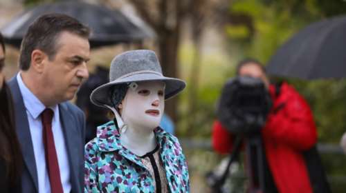 Επίθεση με βιτριόλι: &quot;Στην Αγγλία o δράστης καταδικάστηκε σε δις ισόβια και εδώ θα βγει σε 5 χρόνια&quot;