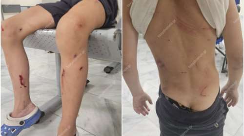 Τρόμος στον Βόλο: Τρία μεγαλόσωμα αδέσποτα σκυλιά παραλίγο να κατασπαράξουν 7χρονο - Σοκαριστική εικόνα