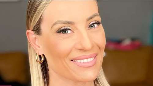 H Ελεονώρα Μελέτη αποκάλυψε την παρενέργεια που είχε το μπότοξ στην επιδερμίδα της