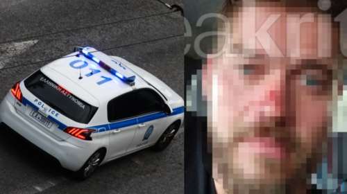 Κρήτη: Σεκιουριτάς ξυλοκόπησε ξεναγό γιατί ήθελε να περάσει από το ξενοδοχείο για να κάτσει στη δημόσια παραλία