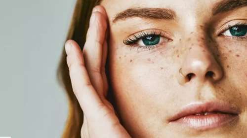 Γιατί γίνεται κατακράτηση υγρών στο πρόσωπο;