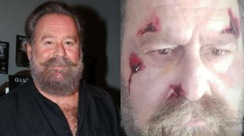 Τροχαίο ατύχημα για τον Κωστή Σαββιδάκη: &quot;Σταματήστε να στέλνετε μηνύματα την ώρα που είστε στο τιμόνι, σκοτώνετε κόσμο&quot;