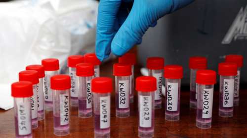 Κορονοϊός - έρευνα: Γιατί ξαναβγαίνουν θετικοί όσοι έχουν αναρρώσει - Σφάλμα στα μοριακά τεστ;