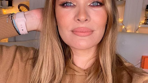 Ανίτα Μπραντ: Τέλος τα μακριά μαλλιά - Να το κοντό καρέ που υιοθέτησε