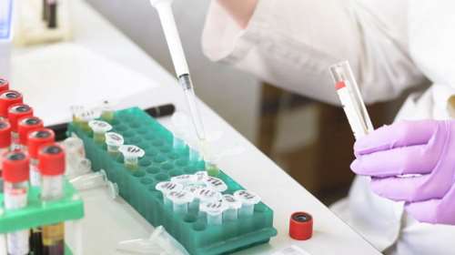 Διευθυντής Ερευνών Παστέρ: Τα δείγματα του κοροναϊού φθάνουν στο Ινστιτούτο με κούριερ