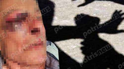 Ανδραβίδα: Άγριος ξυλοδαρμός 77χρονου από ομάδα ληστών